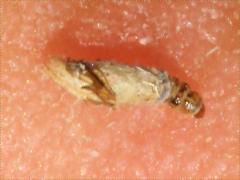 (Dahlica Bagworm Moth) caterpillar